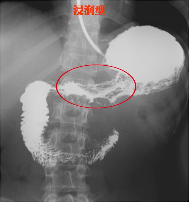 执医技能：X线阅片，全是套路，超简单