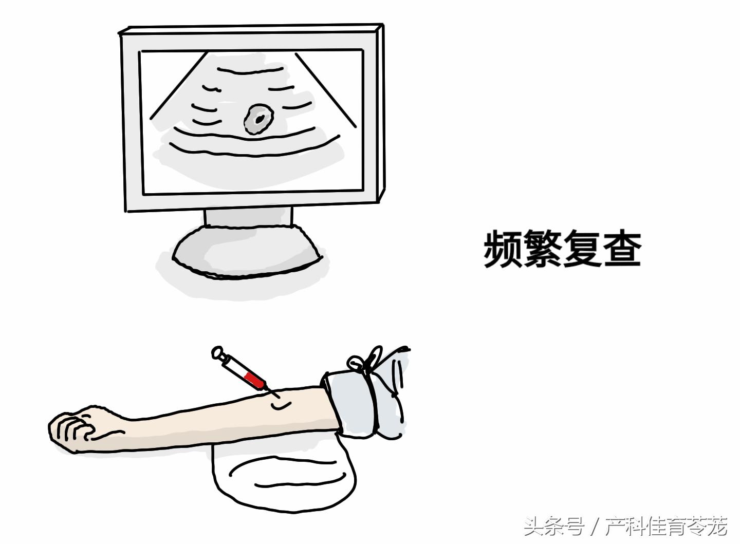 绒毛膜下血肿有保胎的必要吗,绒毛膜下血肿保胎最佳方法