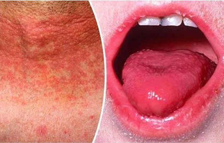 儿童常见传染病近期高发,小儿常见传染病怎么判断和预防