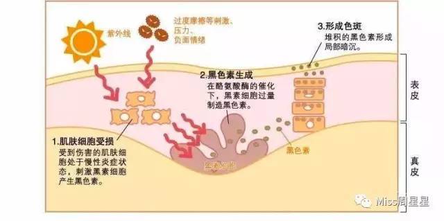 25岁经常熬夜要怎么补,35岁经常熬夜用什么护肤品