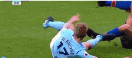 足球史上最可怕的重伤,足球场上恐怖的受伤瞬间断腿