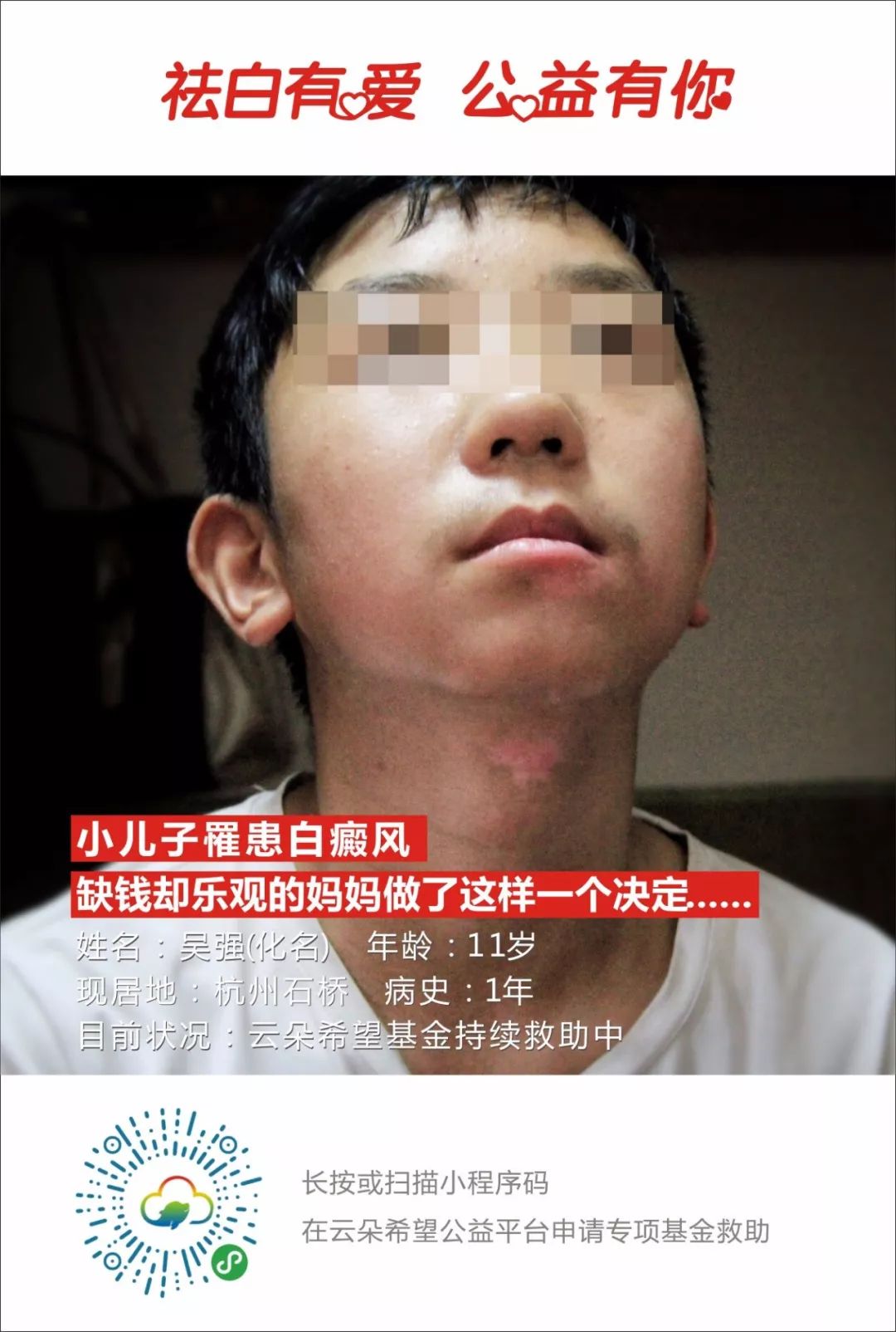 白癜风慈善基金申请,白癜风公益计划