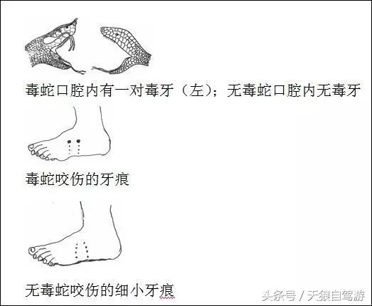 蛇虫叮咬怎么去除,避免蛇虫咬伤的安全措施