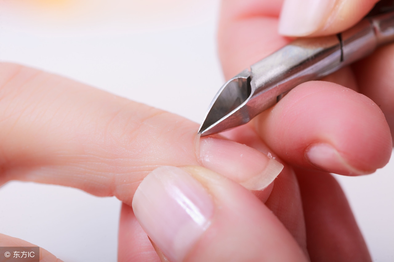 预防和治疗灰指甲有什么特效药,灰指甲怎么形成的怎样预防治疗