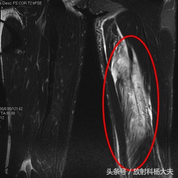 看了这些图，才知道，其实足球是比较*力暴**的运动
