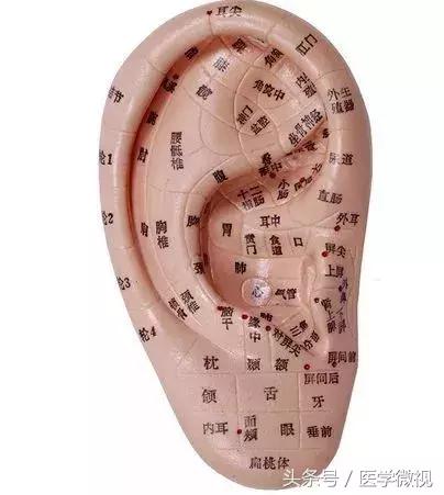 打耳洞真的能让视力变好吗,打耳洞真的对眼睛有好处吗