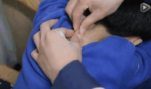 小儿推拿21种手法教程,小儿常见病推拿手法视频