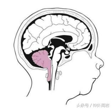 chiari鐣稿舰,chiari鐣稿舰纭瘖