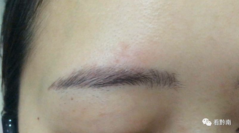 都匀市纹眉,纹眉过敏起小疙瘩很痒图片