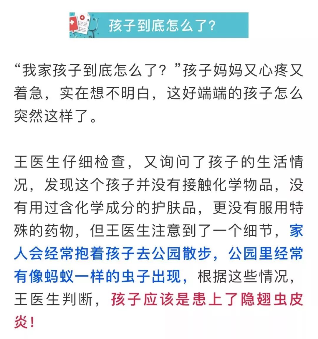 隐翅虫的图片和它的危害,隐翅虫严重后果图片