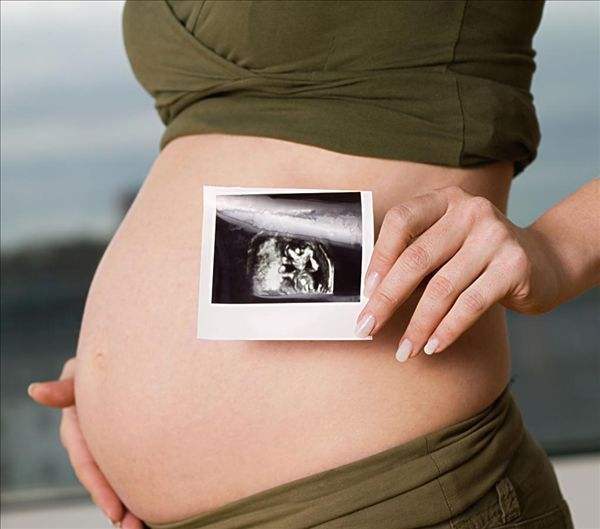 产检查出脑积水引产,孕妇检查时发现自己得了脑瘤