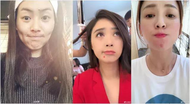 困扰好几年的痘痘终于好了,困扰多年痘痘终于好了