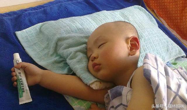 宝宝湿疹和痱子怎么区别,宝宝得了湿疹痱子解决方法