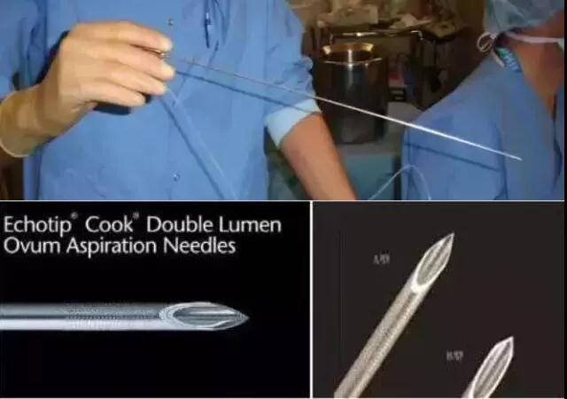 捐卵有多可怕？多少年轻女孩差点把命都搭进去了！