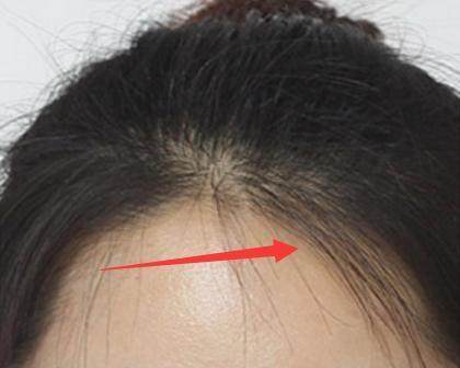 女生碎发处理小妙招,碎发多的女生可以怎么整理碎发