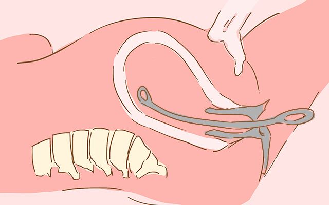 孕早期一直出血为什么胎儿也没事,孕早期有出血胎儿就保不住了吗