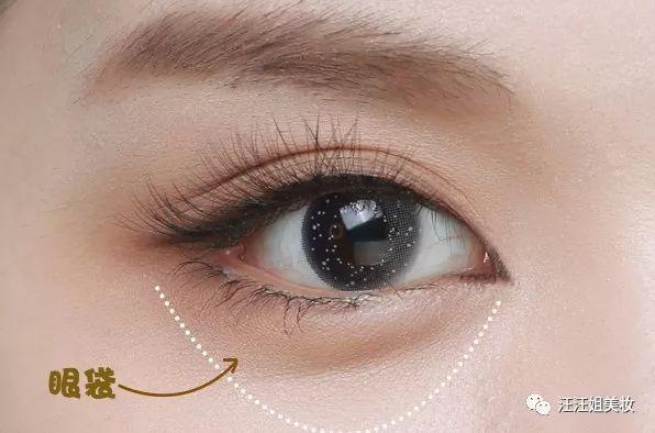 技术贴,双眼皮贴怎么贴出卧蚕