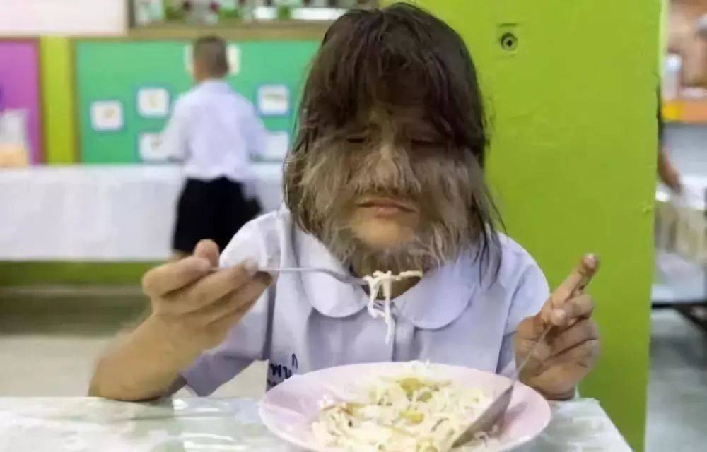 科普年龄大了人的体毛会变白吗,科普毛发的秘密