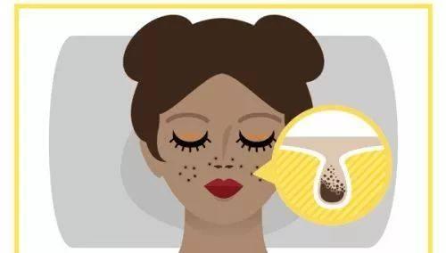 让毛孔变小用什么药,30几岁的皮肤毛孔粗能变小吗