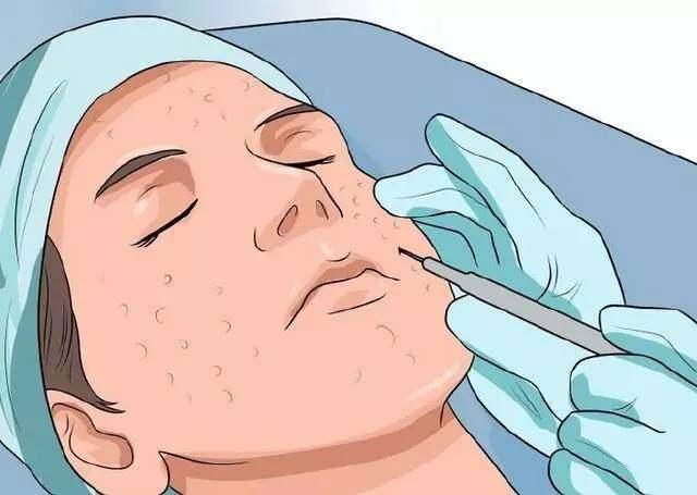 让毛孔变小最快的方法学生,让毛孔变小用什么药