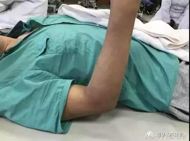 世界杯运动员受伤怎么处理,世界杯球员受伤对方球员赔偿吗