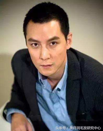 大额头怎么拥有完美发际线,发际线干货分享