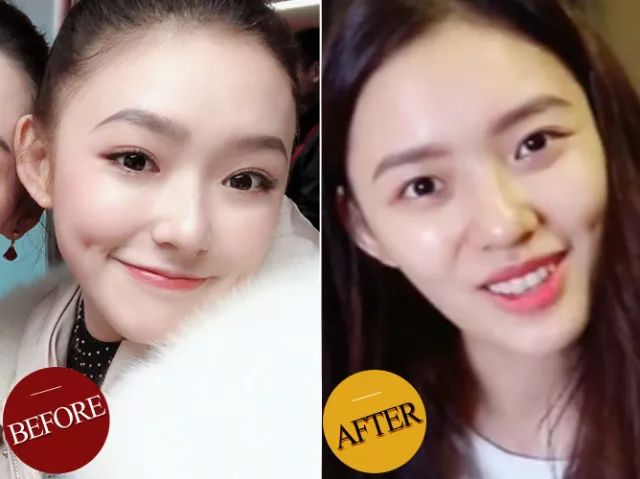 张雨绮煲汤,张雨绮胶原蛋白事件