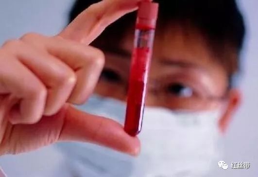 三个症状提醒你感染了艾滋病,为什么感染到艾滋病自己会知道呢