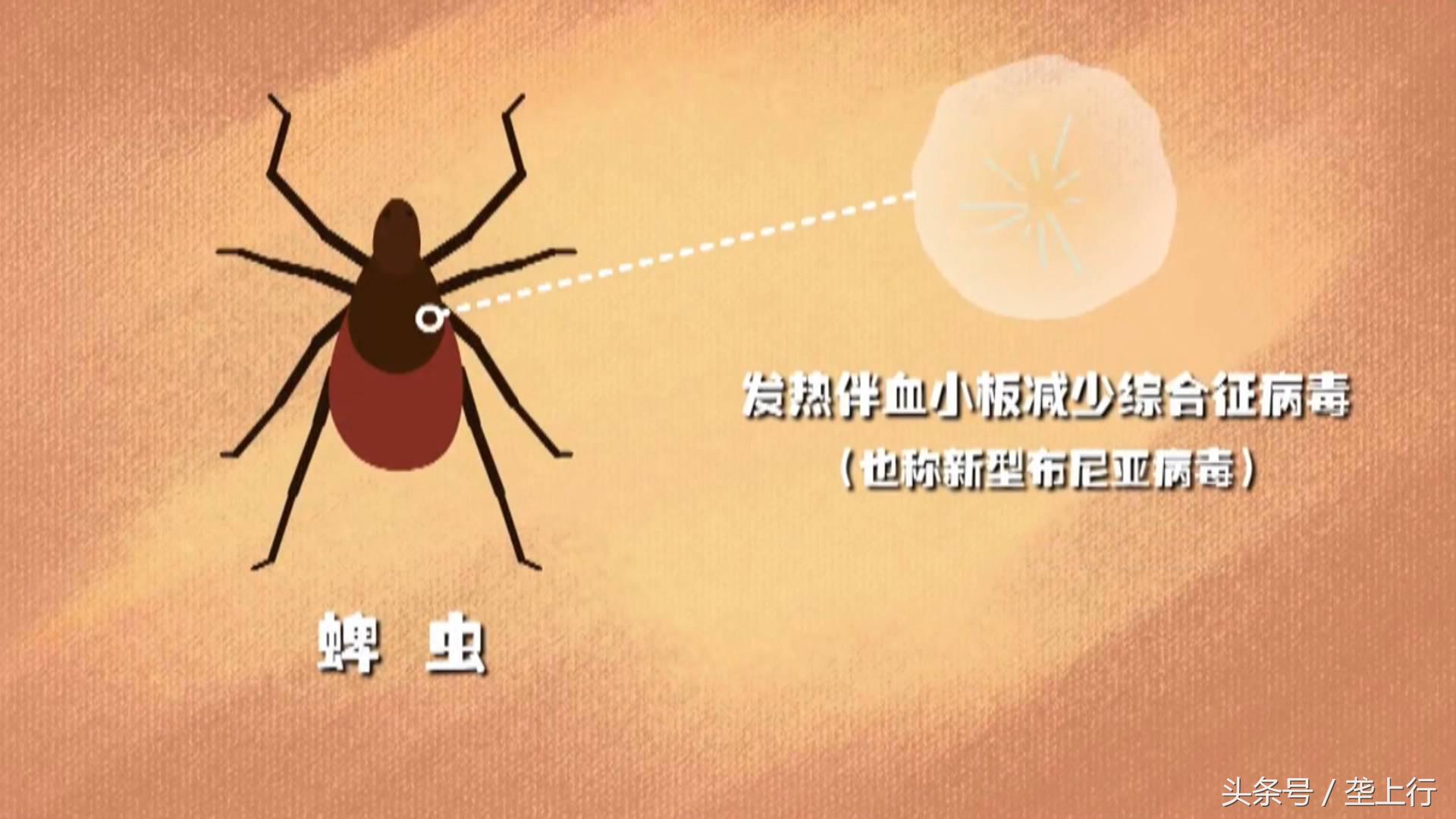 蜱虫叮咬发病有什么后果,蜱虫咬伤症状