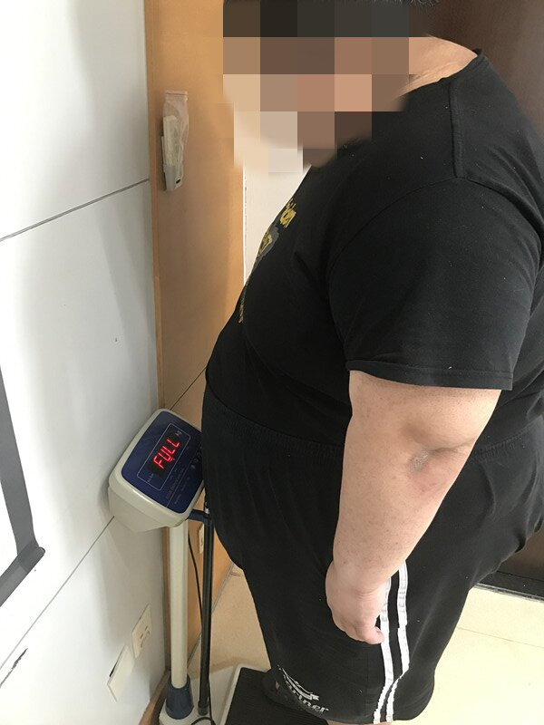 身高1米72，腰围5尺2，体重428斤，200公斤的电子称一脚踩爆表！