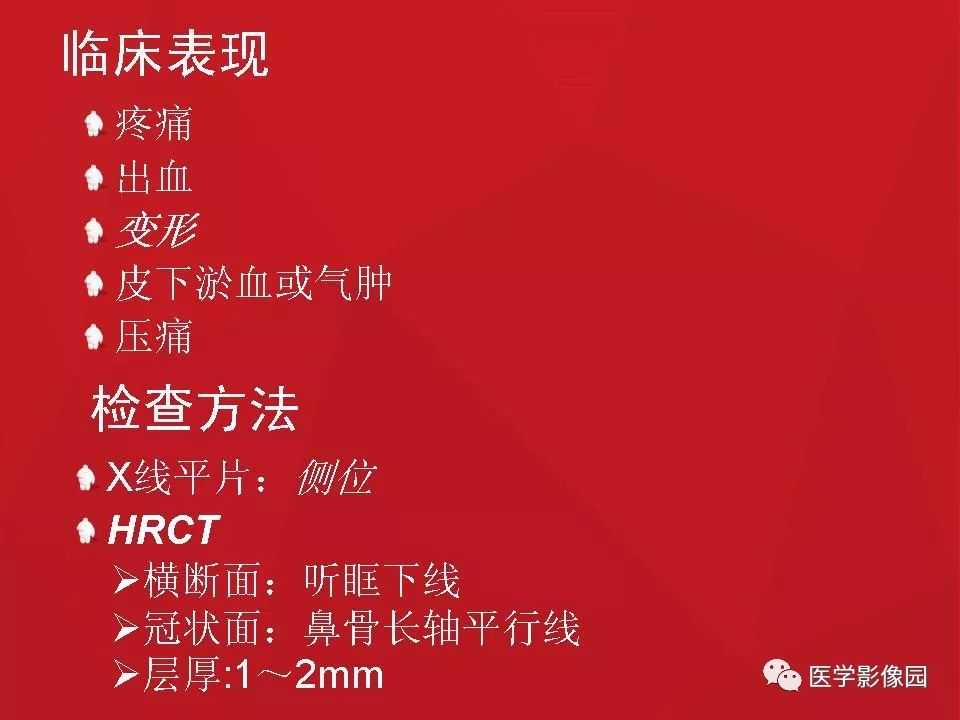 左侧鼻骨骨折伴鼻中隔骨折,双侧鼻骨及左上颌骨突骨折