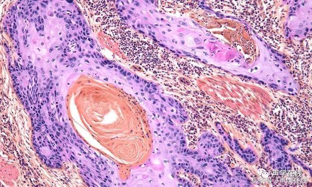 我不是药神惹怒众多癌症患者,我不是药神播出后对医药的影响