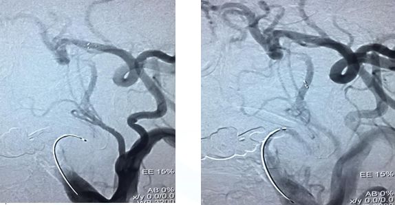 心血管内科急救流程,急诊静脉用药方法
