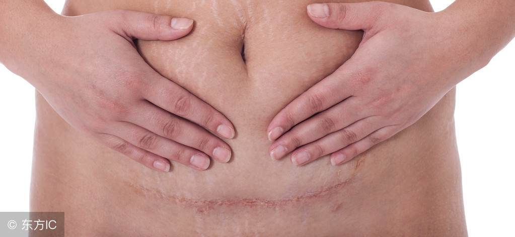 剖腹产后怀二胎要注意什么,剖腹产新生儿出来要注意什么