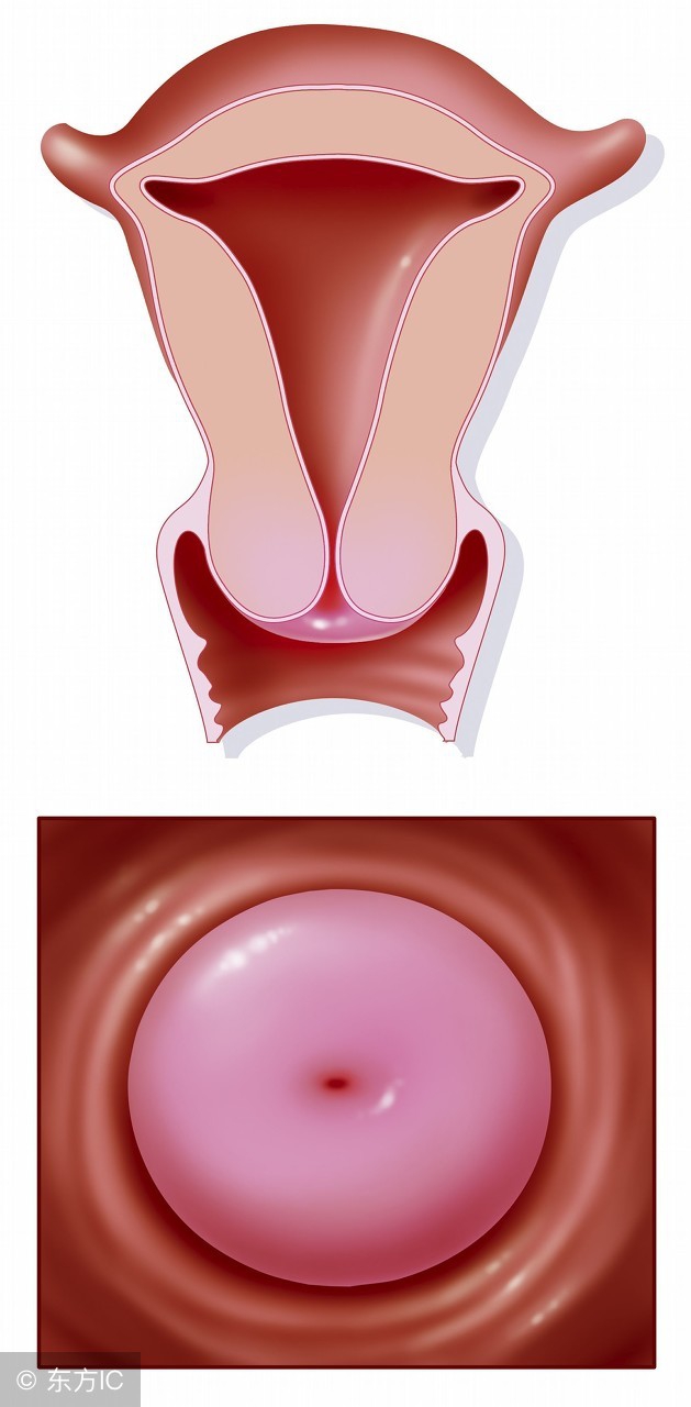 异常出血妇科疾病有哪些,妇科哪些症状会引起阴道出血