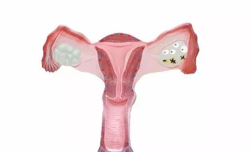 贫穷还是暴富?促排卵取卵,会不会使女性衰老提前?