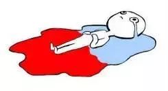 为什么日本女性很少得妇科病,日本女性怎么防护妇科病