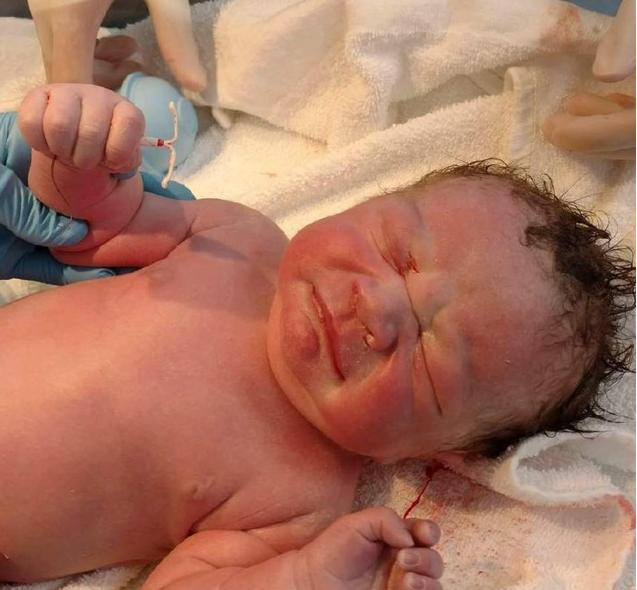 带环怀孕了要怎么处理,带环怀孕的宝宝能要吗真实案例