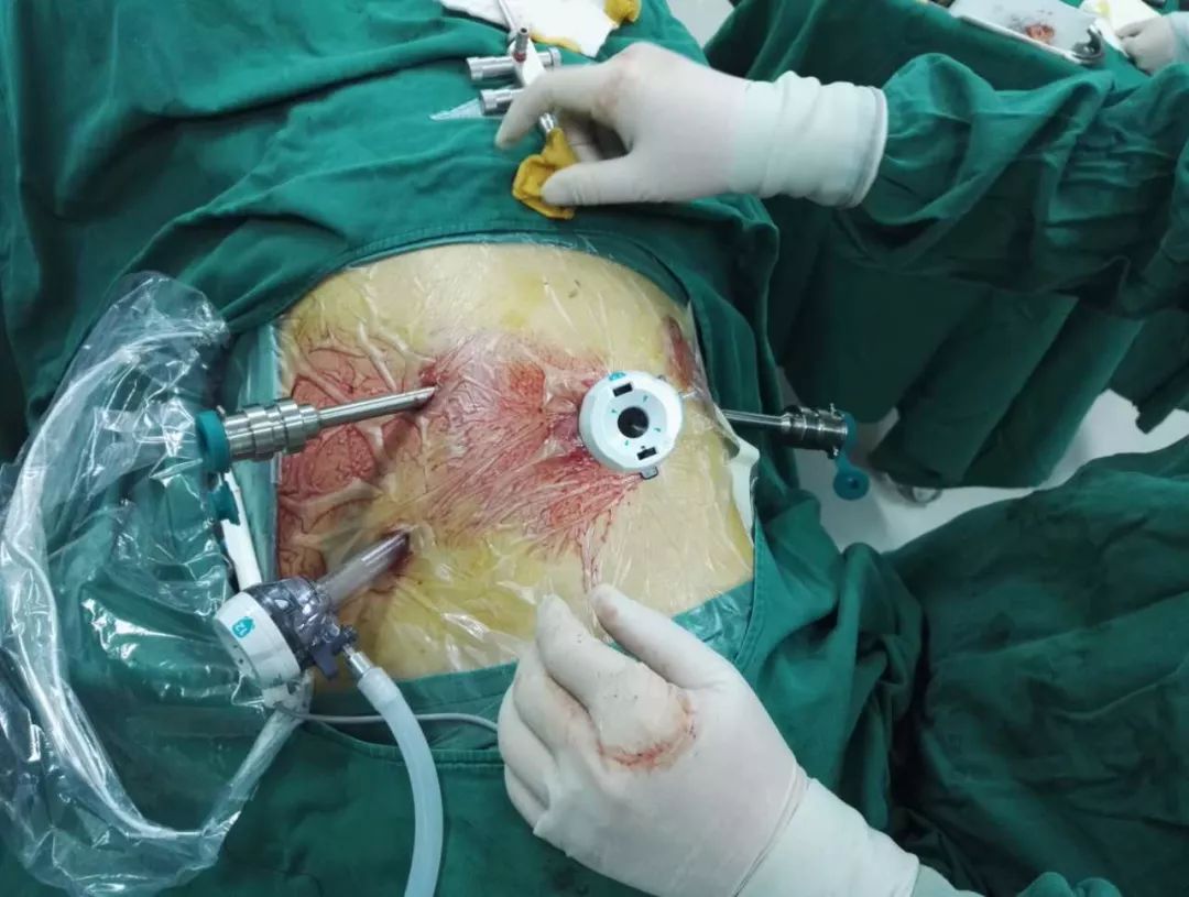 机器人做手术好还是人做的更精准,机器人医生坐诊准确率