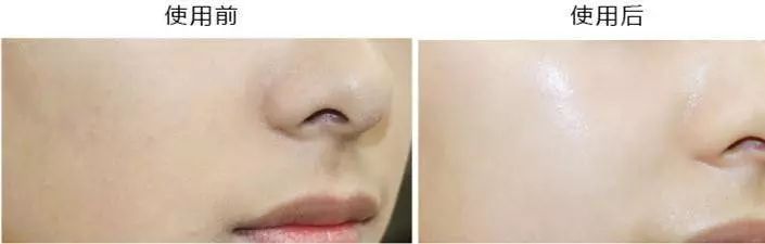 欧洲面膜十大排名,全球排名前十的面膜