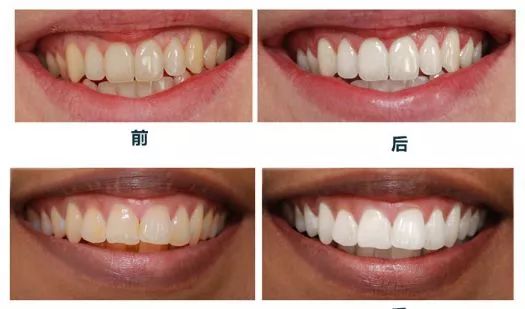 最近有什么网红牙膏品牌,各大网红推荐的牙膏