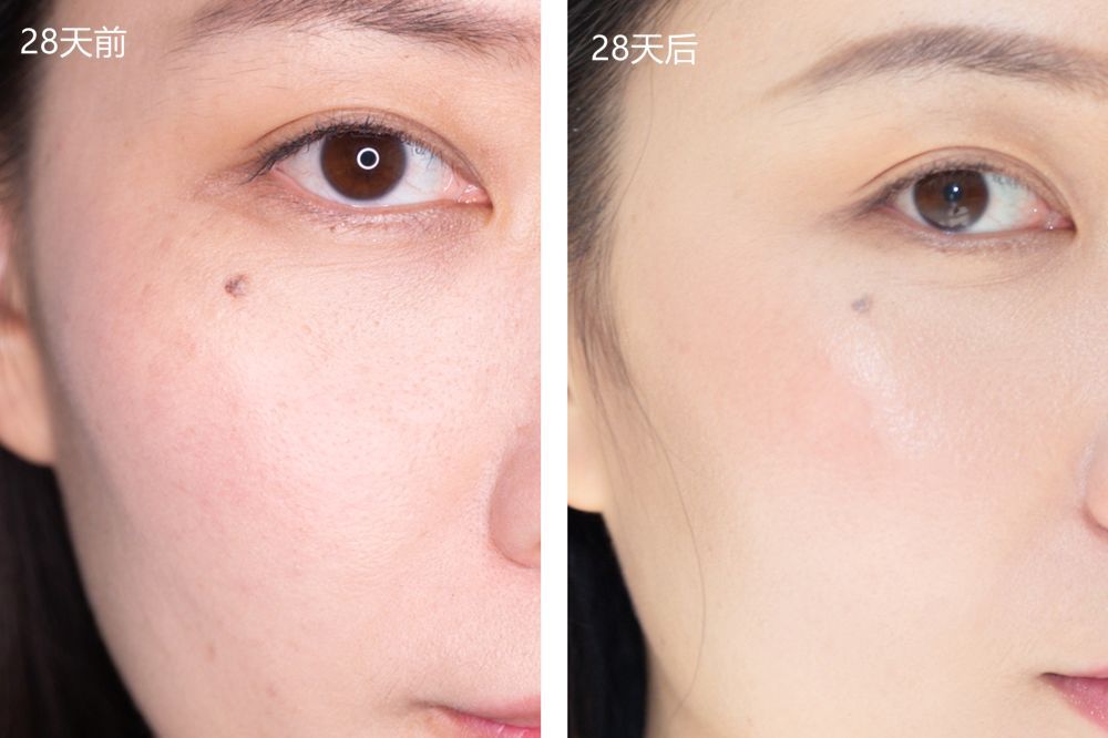 28天解决了所有皮肤问题，你猜我做了些什么？