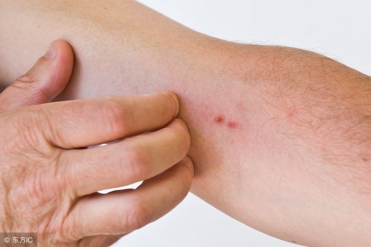 孕妇闻了十几分钟风油精会怎样,孕妇鼻塞不通气可以用风油精吗