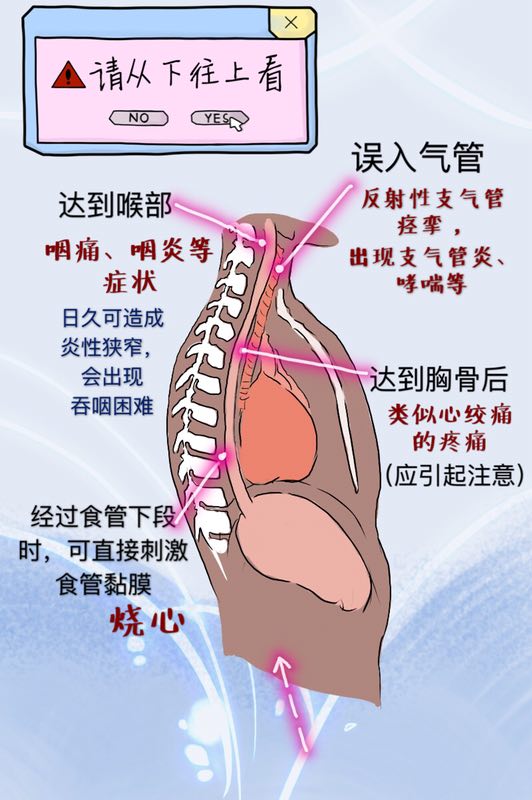 反酸烧心食管堵得慌是怎么回事,胃堵反酸烧心吃什么药