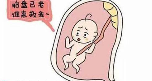 妊娠过期要催产，这些小知识你不得不知！