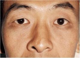 面相几种鼻型的图片,面相鼻子的几种类型图解