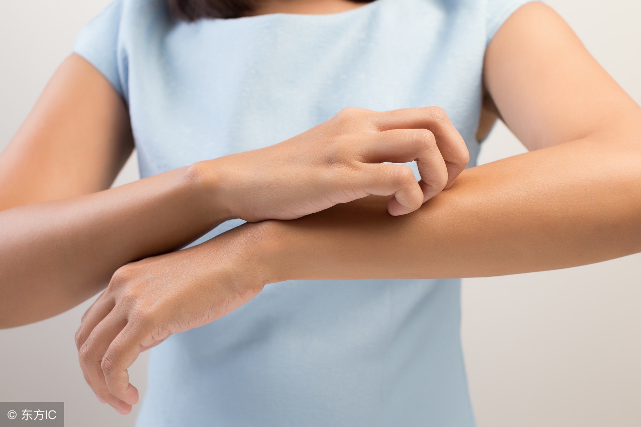 手部干性湿疹和角化湿疹,手部湿疹和脚底湿疹