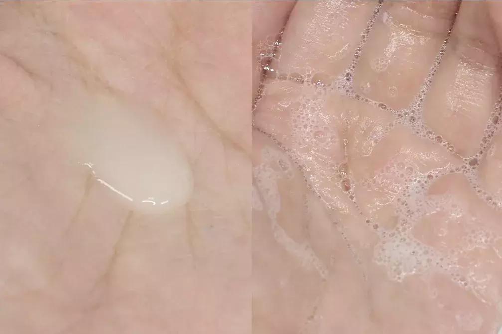 油痘肌夏季护肤思路,油痘肌肤误区