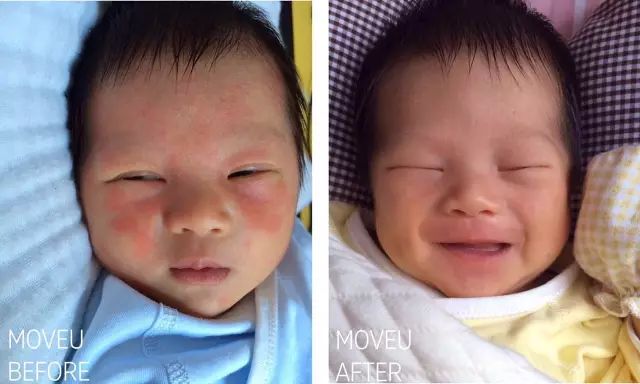 “万用”紫草膏，解决了你多少皮肤烦恼？