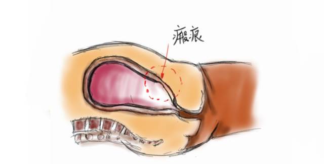孕妈们为啥要做四维彩超,孕妇为什么要做泌尿系统彩超检查